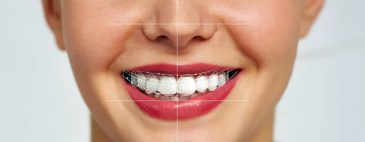 Best Smile Design Treatments In PCMC